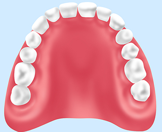 総入れ歯（総義歯）