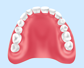 入れ歯（保険適用の場合）